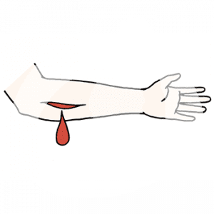Ein Arm mit einer Wunde aus dem ein Tropfen Blut kommt.
