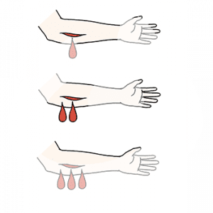Drei Arme mit einer Wunde. Aus dem ersten kommt ein Tropfen Blut, aus dem zweiten zwei und aus dem dritten drei.