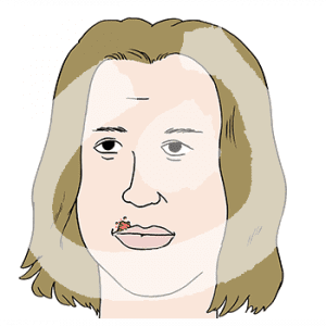 Portrait einer Person mit Herpes an der Oberlippe.