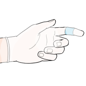 Eine Hand in einem Handschuh. Ein Finger ist unter dem Handschuh mit einem Pflaster verbunden.