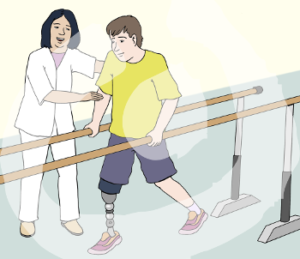Eine Person in einer weißen Pflegeuniform hält eine andere Person mit Beinprothese am Arm fest. Diese Person läuft zwischen einem Barren und hält sich an beiden Seiten fest.